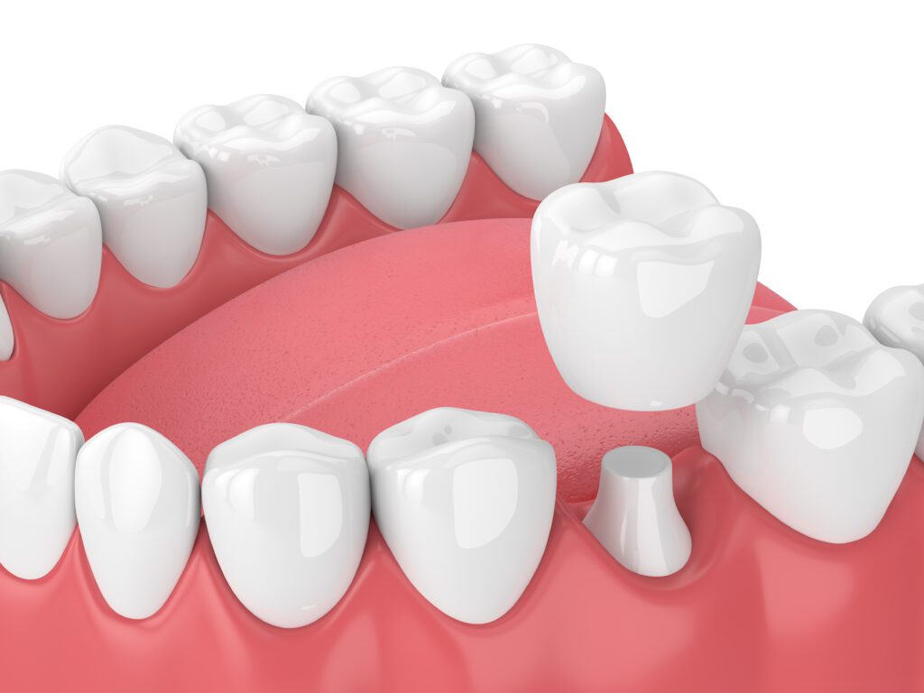 Dentist in Hoffman Estates