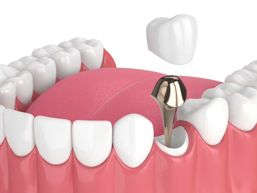Dentist in Hoffman Estates