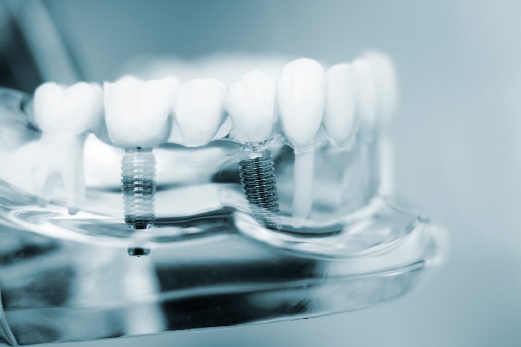 Dentist in Hoffman Estates