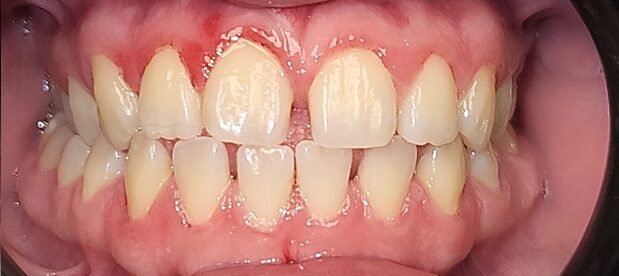 2026-after 2026-after