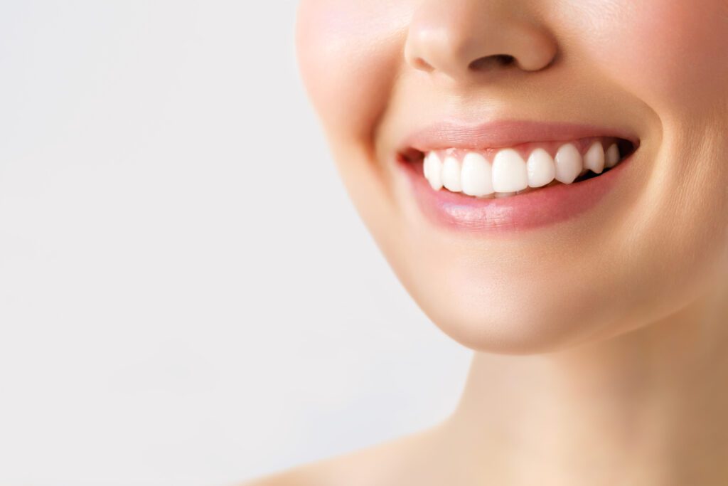 veneers Hoffman Estates, veneers